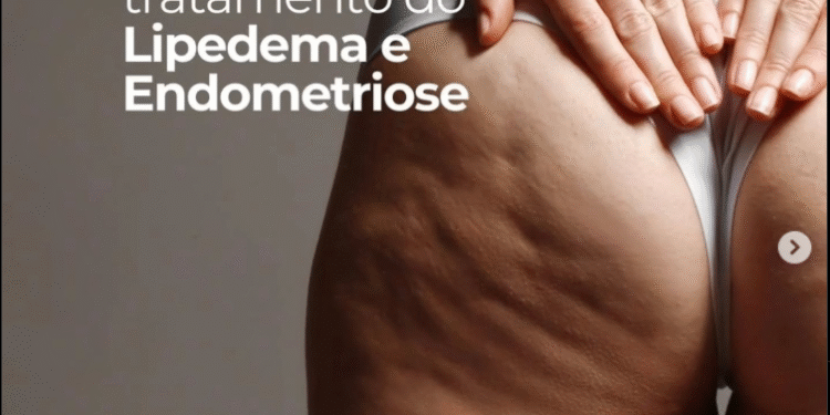 Resveratrol: o aliado natural do equilíbrio hormonal e na saúde da mulher