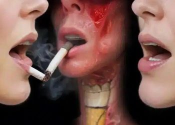 Nicotina, um vilão para sua voz