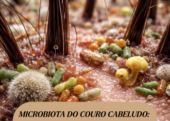 Microbiota do Couro Cabeludo: O novo eixo da Tricologia Moderna