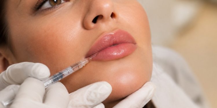 Preenchimento Labial: como valorizar sem perder a naturalidade?